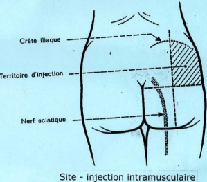 Intra musculaire min