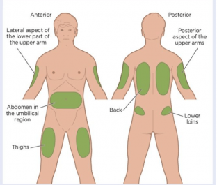 Site d injection sous cutanée